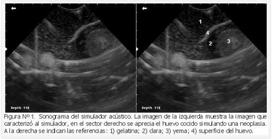 Uso de un simulador acústico artesanal para la enseñanza de la técnica de biopsia guiada por ultrasonografía en el grado. - Image 1