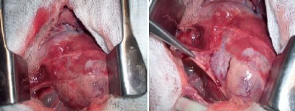 Descripción clínico anatomopatológica de una estenosis pulmonar subvalvular congénita en un canino: reporte de un caso - Image 1