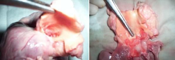 Descripción clínico anatomopatológica de una estenosis pulmonar subvalvular congénita en un canino: reporte de un caso - Image 3