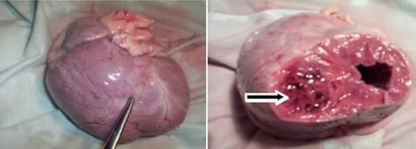 Descripción clínico anatomopatológica de una estenosis pulmonar subvalvular congénita en un canino: reporte de un caso - Image 2