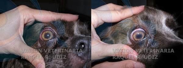 Cirugía del Glaucoma: Gonioimplante - Image 6
