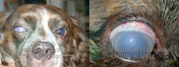 Cirugía del Glaucoma: Gonioimplante - Image 3