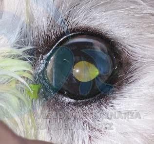 TRASLACIÓN CORNEO CONJUNTIVAL: RESOLVIENDO UN DESCEMATOCELE - Image 5