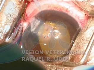 TRASLACIÓN CORNEO CONJUNTIVAL: RESOLVIENDO UN DESCEMATOCELE - Image 3