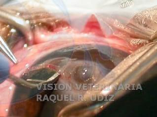 TRASLACIÓN CORNEO CONJUNTIVAL: RESOLVIENDO UN DESCEMATOCELE - Image 1