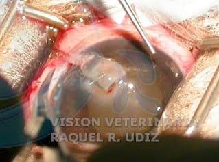 TRASLACIÓN CORNEO CONJUNTIVAL: RESOLVIENDO UN DESCEMATOCELE - Image 2
