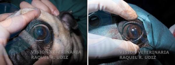 Blefaroplastia Medial - Image 2