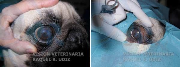 Blefaroplastia Medial - Image 1