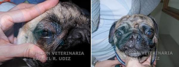 Blefaroplastia Medial - Image 3