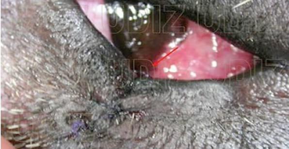 TUMORES PALPEBRALES: QUIRÓFANO Y POSTQUIRÚRGICO - Image 2