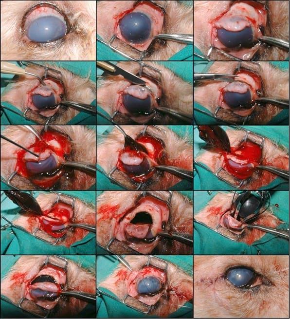 PROTESIS INTRAOCULAR/ INTRAESCLERAL - Image 2