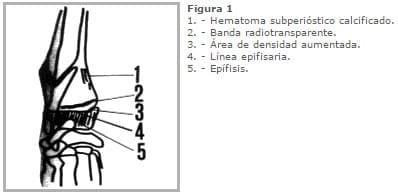 REFORZANDO EL CONCEPTO DE ESCORBUTO - Image 4