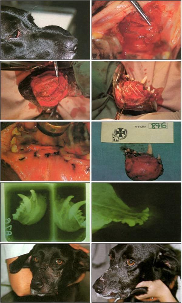 RESULTADOS ÓPTIMOS DE LA OSTEOTOMÍA MANDIBULO-GINGIVO-PALATO-DENTAL EN LOS PROCESOS DE LA CAVIDAD BUCAL. - Image 5