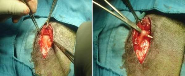 ASPECTOS BASICOS DE LA BIOPSIA DEL NERVIO PERONEAL COMUN - Image 1