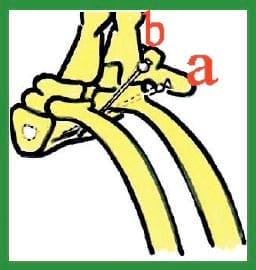 Manual de anestesias y cirugías de bovinos: Sedación, analgesia y anestesia - Image 28