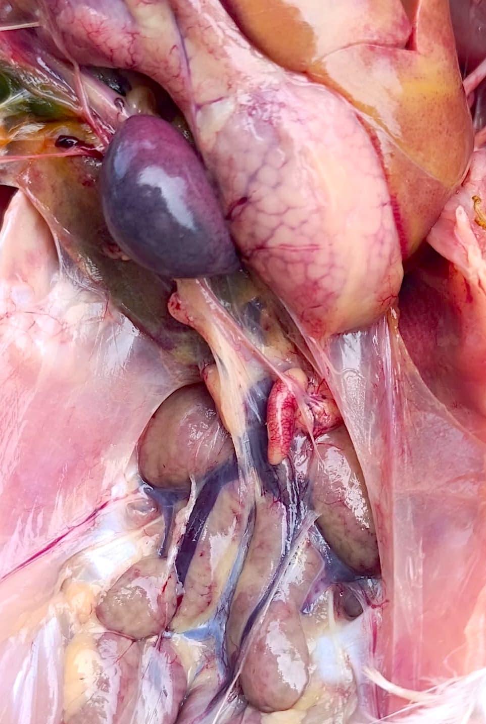 HEPATTIS POR CUERPOS DE INCLUSION SEROTIPO D11 8b 8a Fado 1 - 1