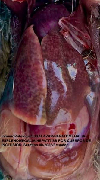 HEPATITS POR CUERPOS DE INCLUSION-SEROTIPO 8b - 1