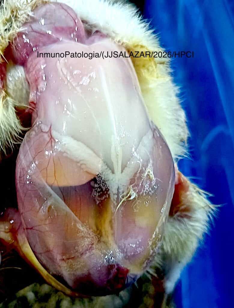 HEPATITIS POR CUERPOS DE INCLUSIO - 3