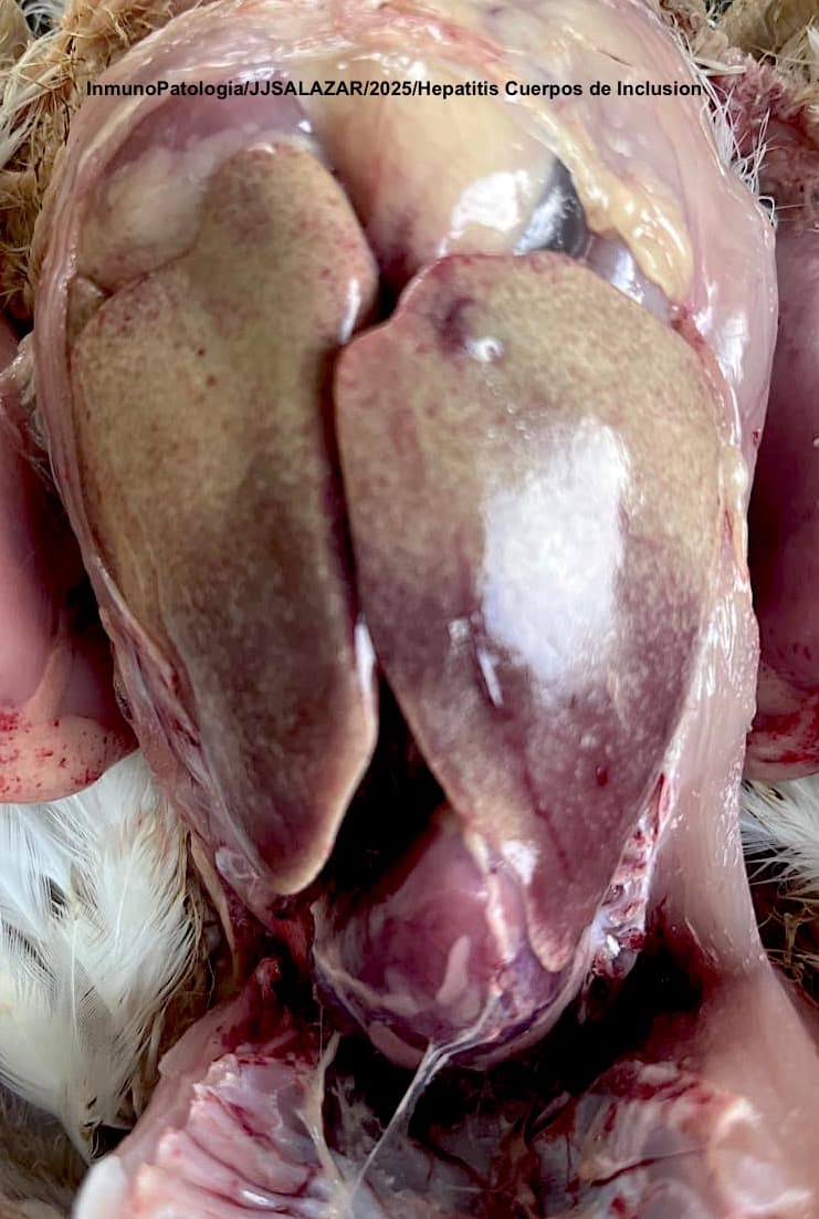HEPATITIS POR CUERPOS DE INCLUSION EN COLOMBIA SEROTIPOS D11-8a-8b - 1