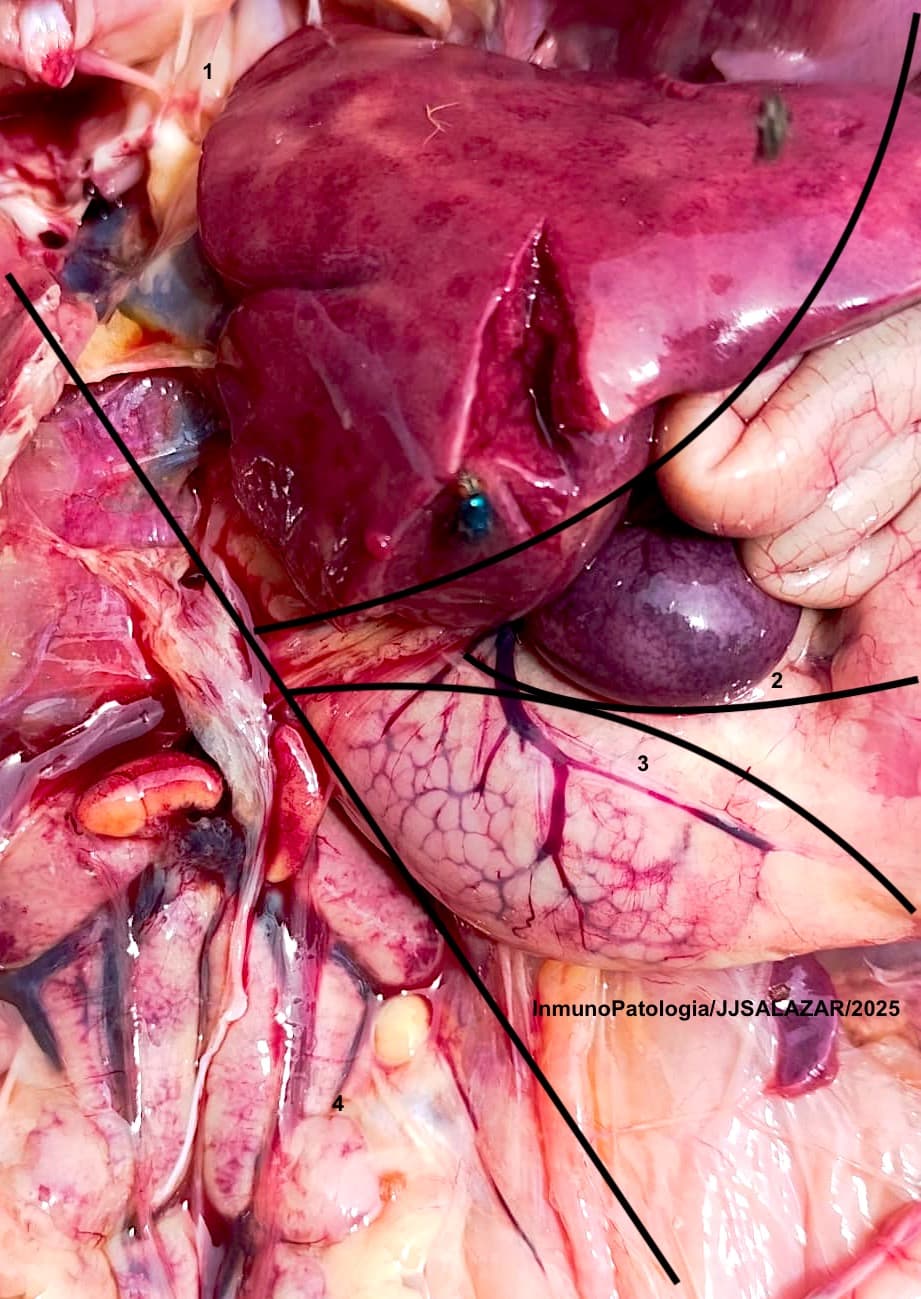 HEPATITIS POR CUERPOS DE INCLUSION EN COLOMBIA SEROTIPOS D11-8a-8b - 2