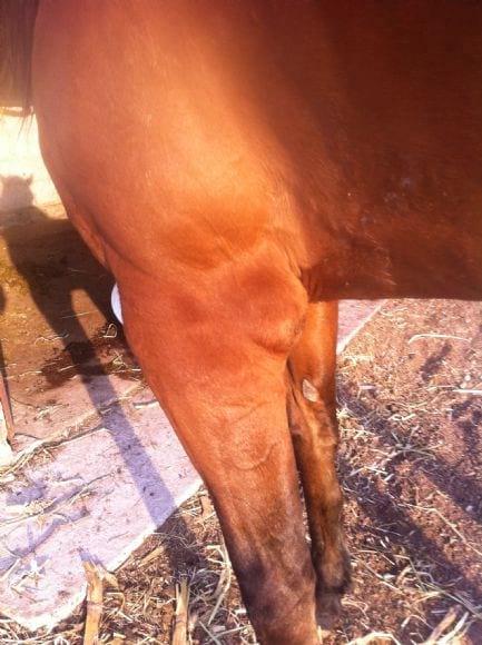 absceso