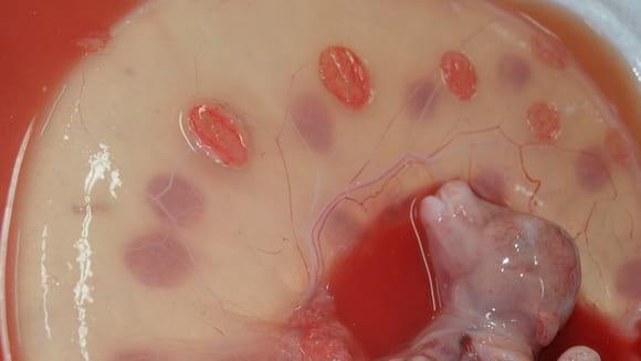 Parte de la placenta de un bovino