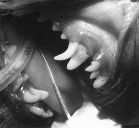 Retencio de dientes deciduos