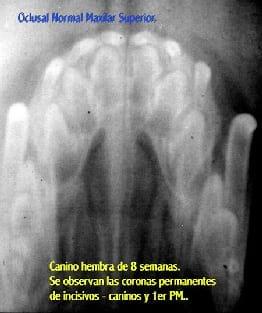 Rx oclusal de incisivos superiores