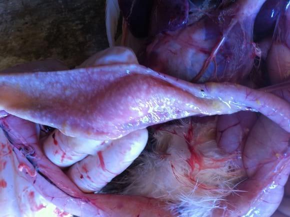 Tumores multifocales en intestino
