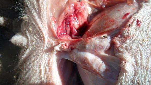 Linfadenopatía de Ganglios Inguinales Superficiales
