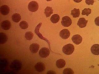 Trypanosoma en muestra de bovino