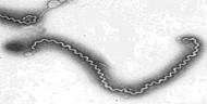 Leptospira spp.