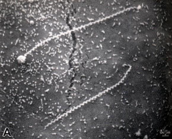 Leptospira spp.