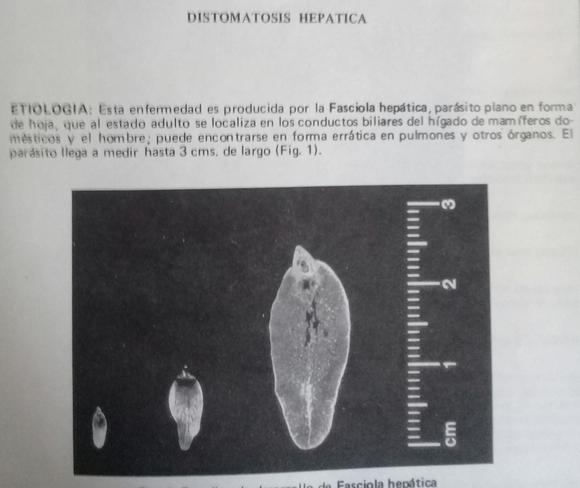 Faciola  hepatica