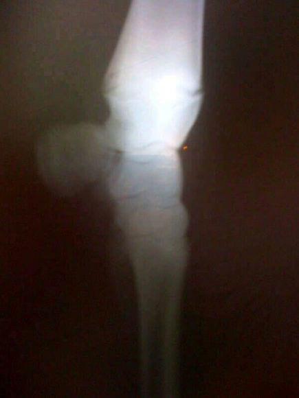 rodilla potro 20 meses