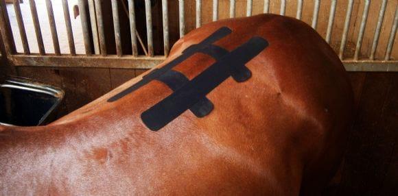 Kinesiotaping