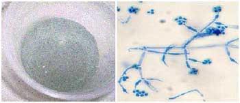 Uso de Insumos Biológicos como Alternativa para la Agricultura Sostenible en la Zona Sur del Estado Anzoátegui - Image 2