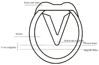 Laminitis e infosura - Image 3