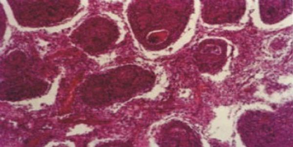 Ocurrencia de la enfermedad infecciosa de la bolsa después de la vacunación con el virus atenuado con bajo pasaje - Image 4