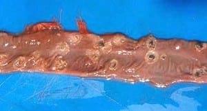 Salmonelosis porcina: un problema global - Image 2