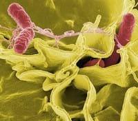 Salmonelosis porcina: un problema global - Image 1