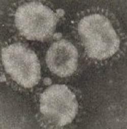 Bronquitis infecciosa – Experiencias en su control con vacunas inactivadas en pollos de carne - Image 1