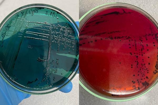 Colombia - Orégano, alternativa natural para atacar la salmonelosis aviar - Image 3