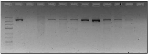 Implementación de la reacción en cadena de la polimerasa (PCR) como método de detección de Streptococcus agalactiae en muestras de leche bovina en Antioquia, Colombia - Image 2