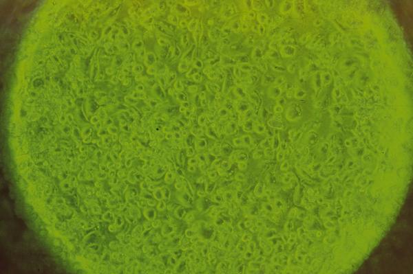 Identificación de biomarcadores de resistencia natural a Mycobacterium bovis en el ganado bovino - Image 8