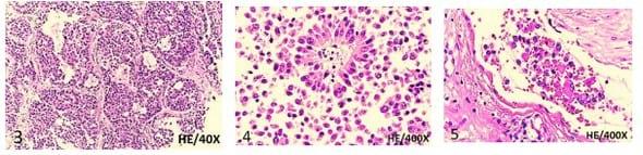 Tumor de células de la granulosa maligno en una vaca holstein. - Image 2