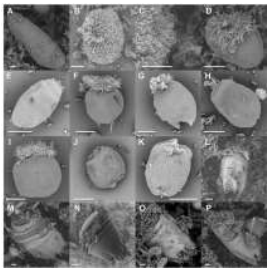 Figura 1. Fotografías de protozoarios identificados en el rumen del novillo Braford mediante microscopia electrónica de barrido. Se identifican protozoos del género Isotricha (A), Dasytricha (B-C), y de las subfamilias Entodiniinae (D,F-I), Diplodiniinae (E,JK) y Ophryoscolecinae (NP). Las barras indican 10 µm en todas las imágenes.
