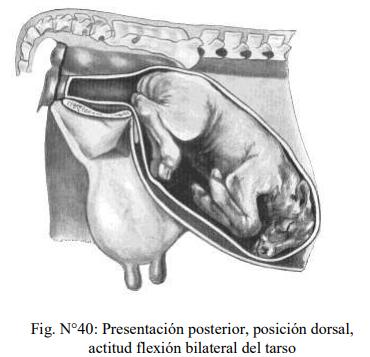 Obstetricia y neonatología bovina: XI. Estática fetal Anormal - Image 8