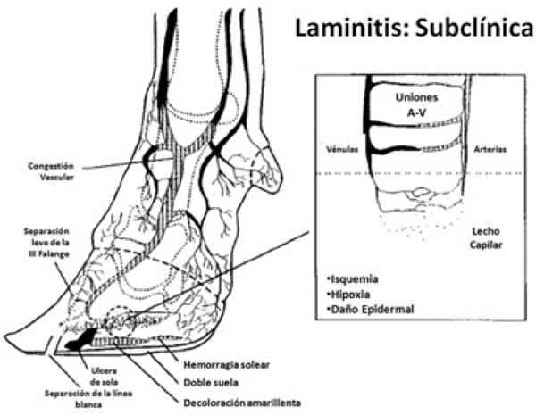 Figura 4. Formación de anastomosis arteriovenosas en la laminitis subclínica (Nocek 1997).