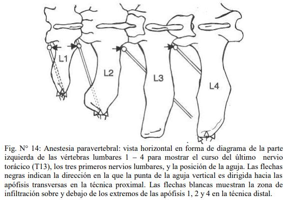 Obstetricia y neonatología bovina: VII. Anestesias en obstetricia - Image 3